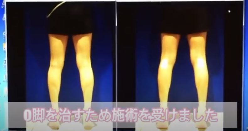 韓国式o脚改善 ふくらはぎが細くなるおすすめの激痩せストレッチ方法をご紹介