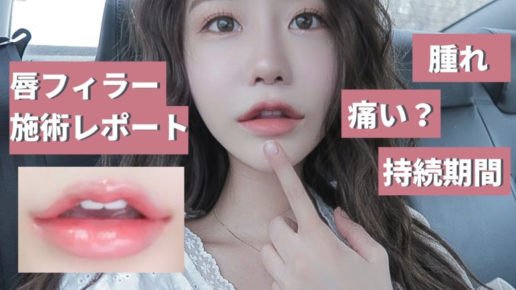 韓国整形リアルレビュー 人気の 唇フィラー 痛みは 持続期間は 唇フィラー 気になる疑問を語ります