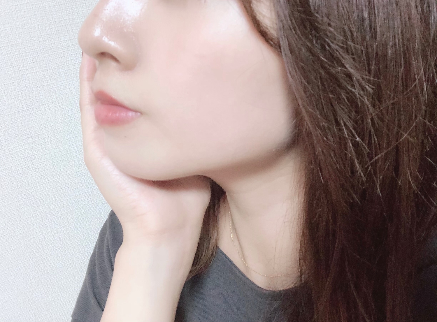 韓国での糸リフト整形は有名 日本との価格比較や失敗リスクを徹底解説