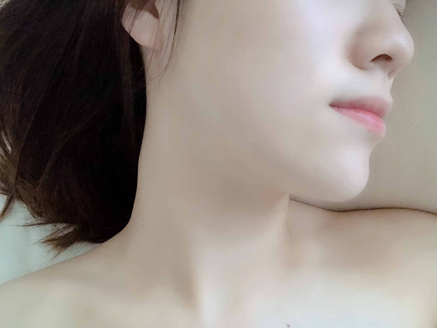 幼い頃から悩んでいたニキビ跡が嘘のように消えた韓国美容皮膚科レポ