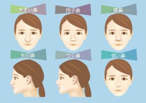 決定版 韓国の鼻整形説明書 悩み別手術方法からダウンタイムまで徹底解説